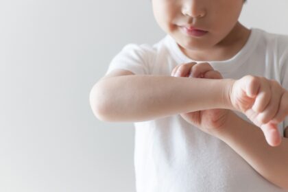 お子様の乾燥肌について